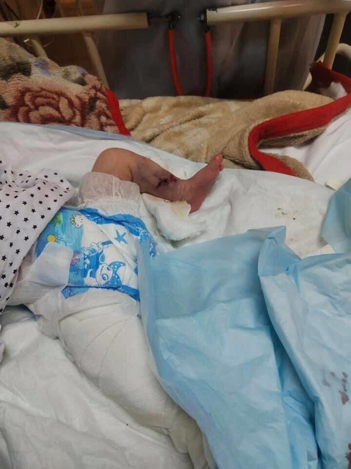 MonikaRadhakri1's tweet photo. It's really inhumane act and barbarian attack #kabulattack 
#KabulHospitalAttack 

Feeling worthless of being human 😐..
The innovators (Newborn) of the world if destroyed like this the situation thus leads to ...? https://t.co/aTahpDGkV5