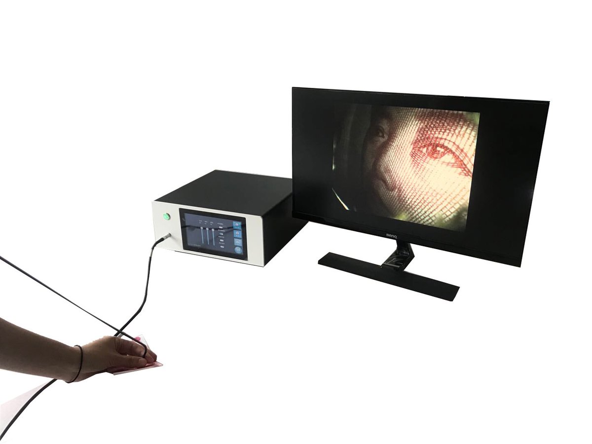 ElaineTong4's tweet photo. #Resistone disposable flexible ureteroscope with high resolution has been perfect performed in hospital.
1. 160K Resolution with high restore
2. Fully standard 9Fr outer diameter and 3.6Fr working channel
3.Flexible, dual 275 degree
4. Touch screen designed with adjustable https://t.co/vHO3Tfqsco