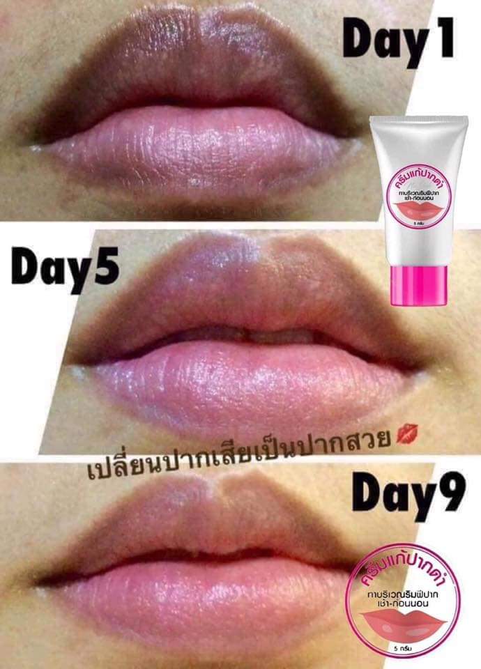 cosmetics_sky's tweet photo. #รีวิวโครตเยอะเลย​ ลิปแก้ปากดำ​ น้องใหม่่มาแรง​ แบรนด์​น่าจุ้บ​ ช่วยให้ปากนุ่ม​ ชุ่มชื่น​ ไม่ลอก​ และทำให้ปากอมชมพูขึ้น
#รีวิวจากผู้ใช้จริง🔥🔥
#ตอนนี้มีโปรส่งฟรี​รีบมาตำกันจ้า https://t.co/ov0JEjPJMS