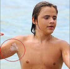 6) Besides, MJ´s kids do look like him and some even inherited his vitiligo.