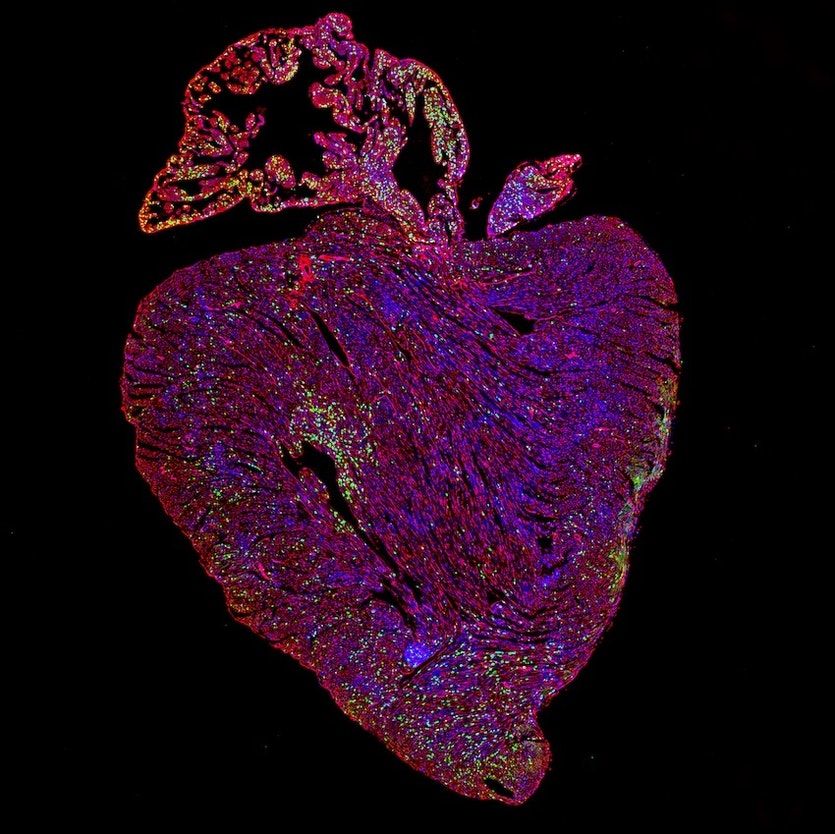 HLTHRun's tweet photo. Researchers have found a gene that raises the cancer cells but this cancer gene also helps in repairing the heart. This could be the key to cell regeneration https://t.co/4PNnorXzbz
#CancerGene #genomics #genes #shivom https://t.co/vj7tHv3Nb0