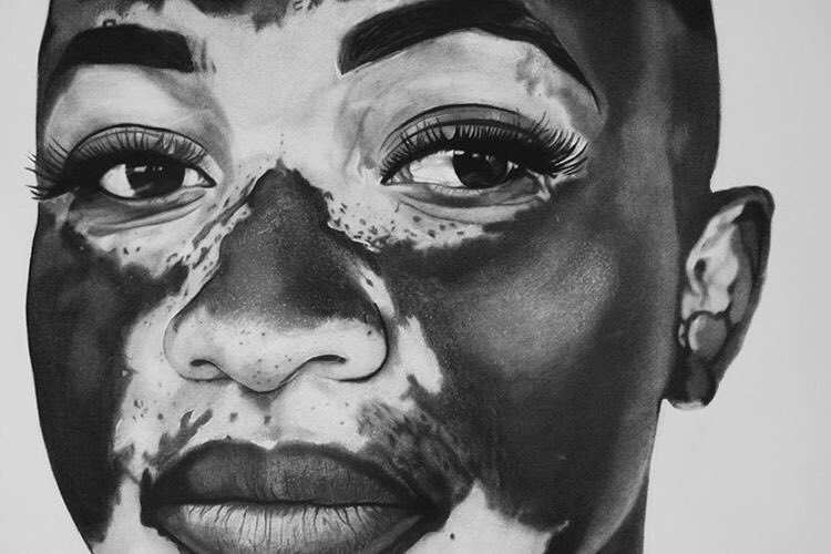 MugabeRumbidzai's tweet photo. If you see something, say something ••• ARTIST: @Salem sinoia
Thank you I love it 🖤
#self love #vitiligorocks #yummymummy #thesegenesaintnojoke #choconilla #blaquexellence #blackgirlmagic #blackgirlsrock #blackgold https://t.co/ckWXBbI1xq