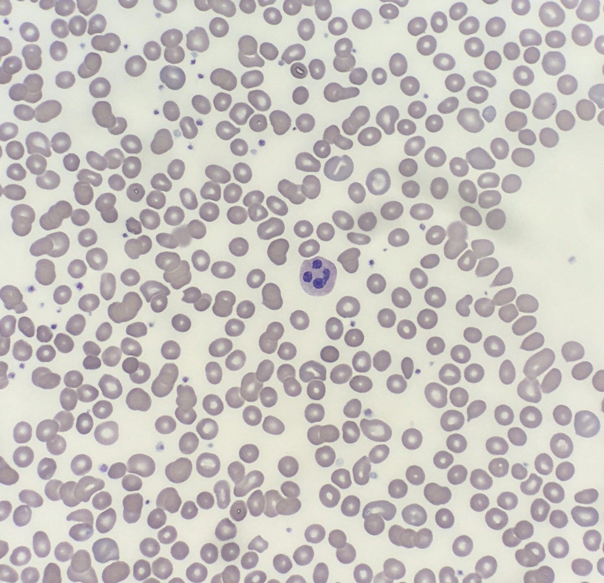 CMullins_MD's tweet photo. Happy #humpday from this smiley guy! #hemepath #howisitonlywednesday https://t.co/pY9zweqEGa