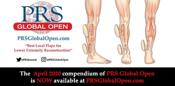 AraSalibianMD's tweet photo. The new compendium of #PRSGlobalOpen is available now!
Read amazing #FREE articles, like "Best Local Flaps for Lower Extremity Reconstruction": https://t.co/45C2MQg5Hb
#plasticsurgery #perforatorflaps https://t.co/RylPPs9wIf