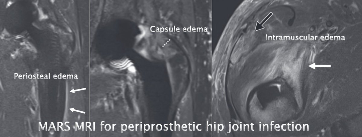Christian Pfirrmann tweet media