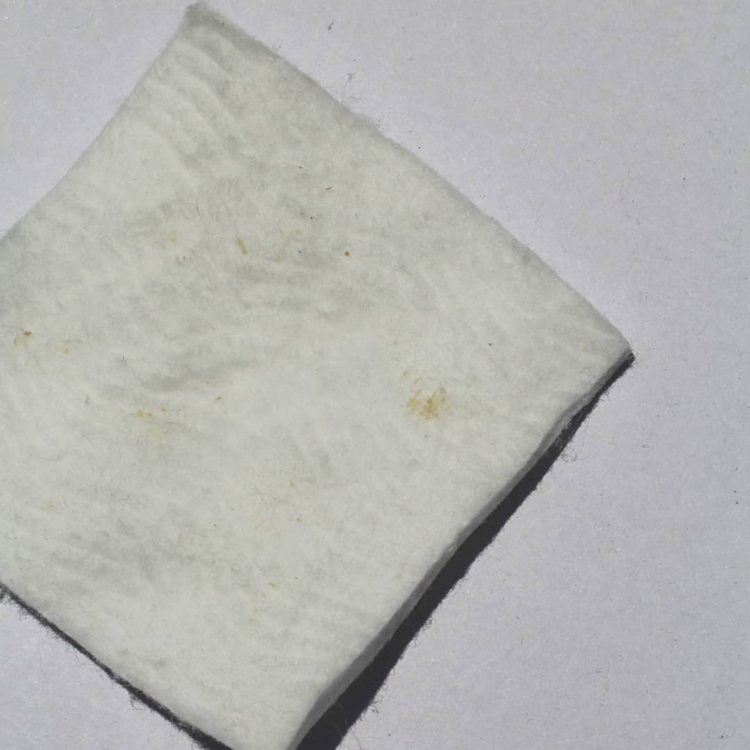 sarinizainal's tweet photo. Harini saya nak share #teknik155 untuk buang Blackhead / Whitehead tanpa menyakitkan, tanpa membesarkan lagi pori, tanpa tools mahal. Kalau konsisten, memang dah tak ada hidung berbiji-biji dan berbintik hitam lepas ni. Kita nak buang benda dlm gambar ni 👇🏼 https://t.co/yf3jKWFESD