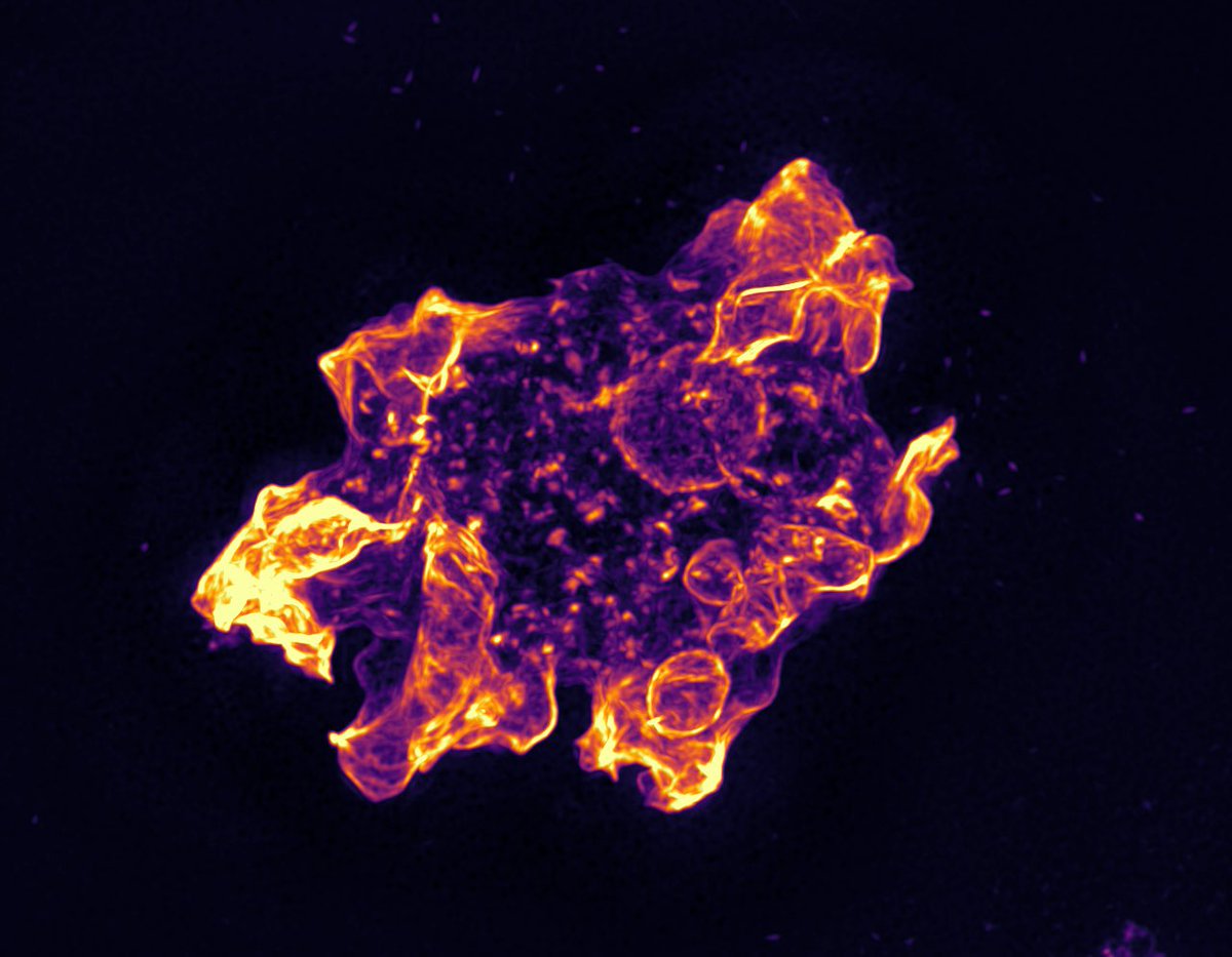 No microtubules? No problem! Naegleria use #actin and Arp2/3 complex to crawl and eat. 
Check out our (w/ <a href="/FritzLaylin/">Lillian Fritz-Laylin</a>) preprint; we would appreciate your constructive feedback 😀
(1/n)