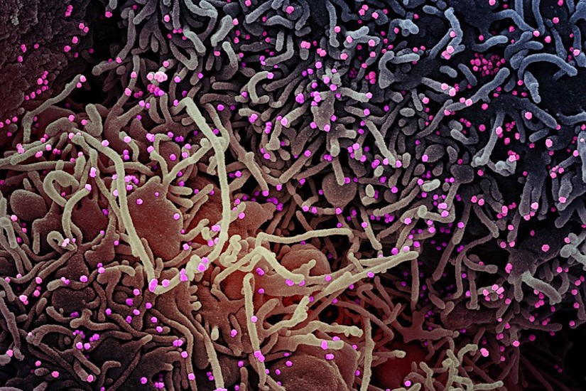 UWMadCBE's tweet photo. Prof. John Yin has received a National Science Foundation Rapid Response Research (RAPID) grant and an Early-Concept Grant for Exploratory Research (EAGER) to work on projects related to human coronaviruses.

https://t.co/5Eg5nAPQbe https://t.co/0AKzh4rrfv