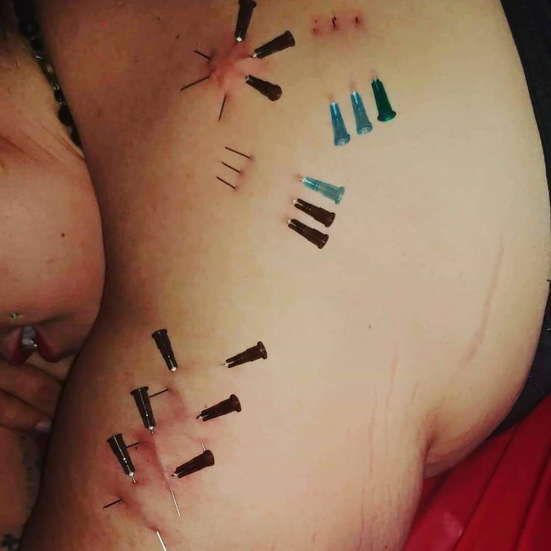 PiercingByBlue's tweet photo. The satisfied look after a first play piercing experience. Thank you @jasmine_zolie_francoeur . Needle play by me, done at Triskelion; Private BDSM club.

#playpiercing #needleplay #BDSM  #temporarypiercing #playingwithneedles #bodymods #bodymodification #pierced https://t.co/GVVGICDgAK
