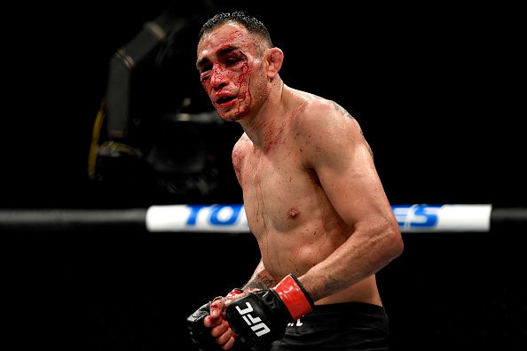 MMASucka's tweet photo. Fights to Make After UFC 249: The Losers - https://t.co/jY3rLMUVIz https://t.co/EfWH7dvGdN