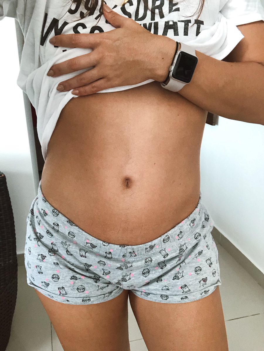 Alicestupinan's tweet photo. Para que entiendan, sufrir de colon irritable es estar un día así y al otro día embarazada: https://t.co/6qhK5WKEiu