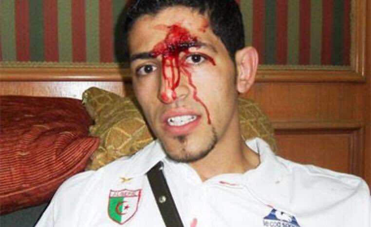 3bdullah66's tweet photo. قصة مباراة / 

"معركة ام درمان " 

🇩🇿 الجزائر  🇪🇬 Vs مصر 

المناسبة : تصفيات كاس العالم ٢٠١٠ 🇿🇦 . 

- المباراة اللي صاحبها صخب جماهيري 
بعد فوز الجزائر ذهاباً وقبل مباراة الاياب اعتداء بعض الجماهير المصرية ع حافلة لاعبين المنتخب الجزائري 👇🏻: https://t.co/5opWC4JFZ2