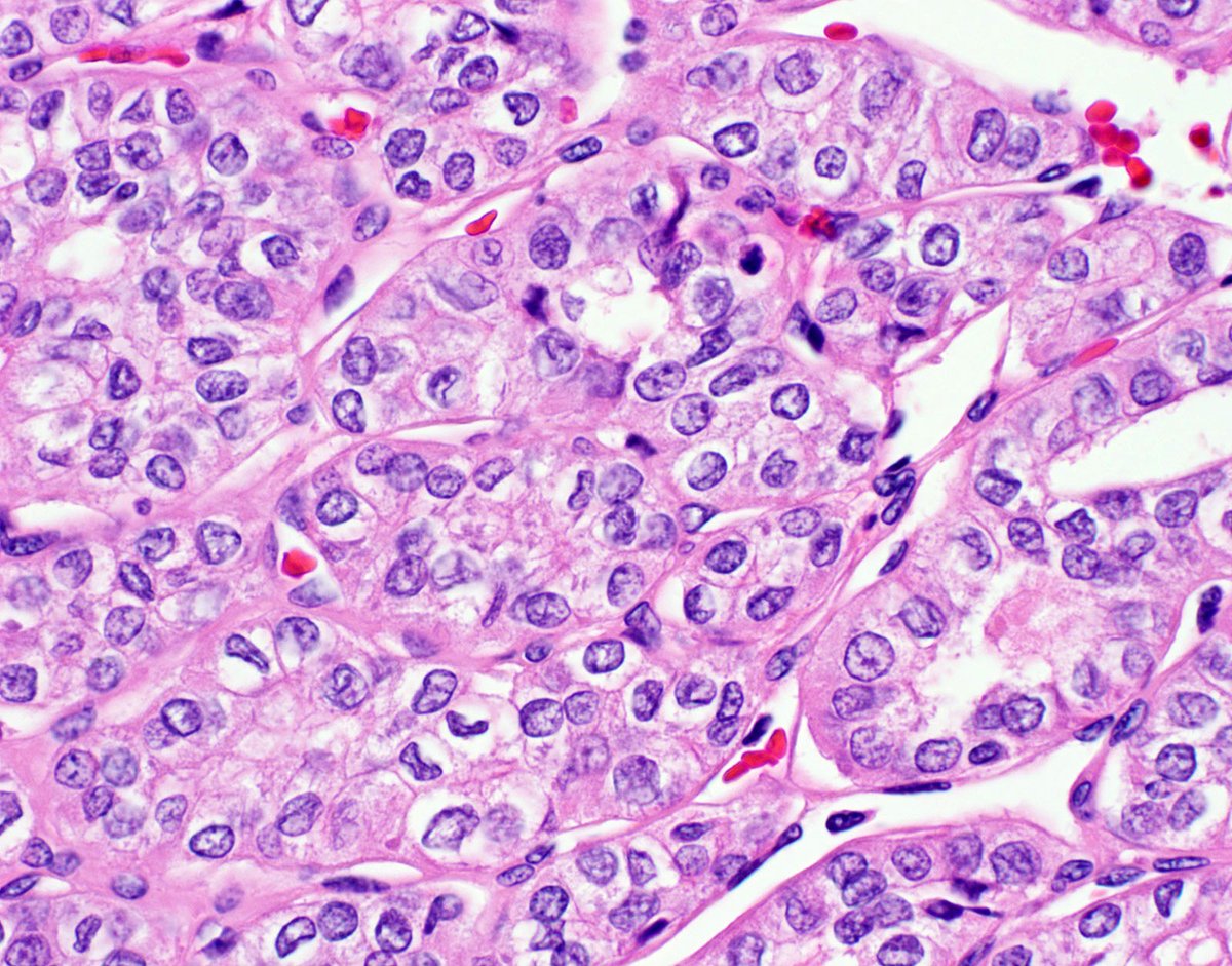 David Hernandez Gonzalo tweet media