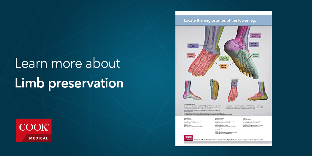 cookvascular's tweet photo. Limb preservation program key to treating BTK disease. Read more ➡️ https://t.co/DPCvjS3Thy #CookBTK #BTK #CLI #angiosome https://t.co/QLs0SknPqX