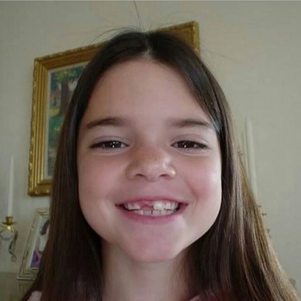 itwasnotadream1's tweet photo. it was not a dream but it was one of my fears for my teeth in my childhood. https://t.co/cwyfl7ox68 
@MoonOralCare @POTUS 
 
@KendallJenner https://t.co/37vouq6rwW