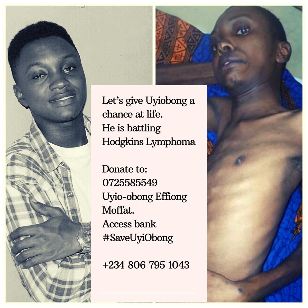 droayung's tweet photo. Every time I talk to him on phone he sounds so hopeful and tries to be cheerful..hiding his pain.
No one deserves to suffer like this.
I am asking for help on behalf of Uyiobong and his family..
Your RT and/or donations will go a long way..
Let's help #SaveUyiObong
Hope Above All https://t.co/678loxWwUv