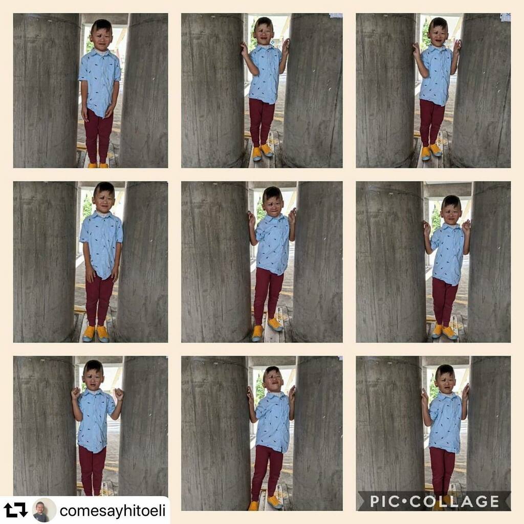 WishlistCTW's tweet photo. 💙 #repost @comesayhitoeli
・・・
Busted out of the house for a doctor appointment! ☀️☁️☀️ #CauseTheWave to #HealEB
#EBRP #EpidermolysisBullosa
#EddieVedder #PearlJam #ComeSayHi #EBwarrior #RareDisease #VenturePhilanthropy #Donate #GeneticDisorder https://t.co/za5PMXIoT5