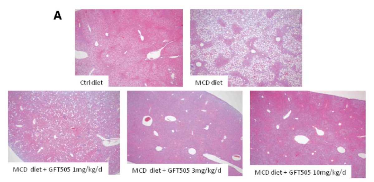 In pre-clinical models, elafibranor was reported to have strong effects on both elements of  #NASH in dietary models and also on fibrosis in a CCL4 model https://aasldpubs.onlinelibrary.wiley.com/doi/epdf/10.1002/hep.26461This was enough to move into patients and the GOLDEN-505 trial5/n