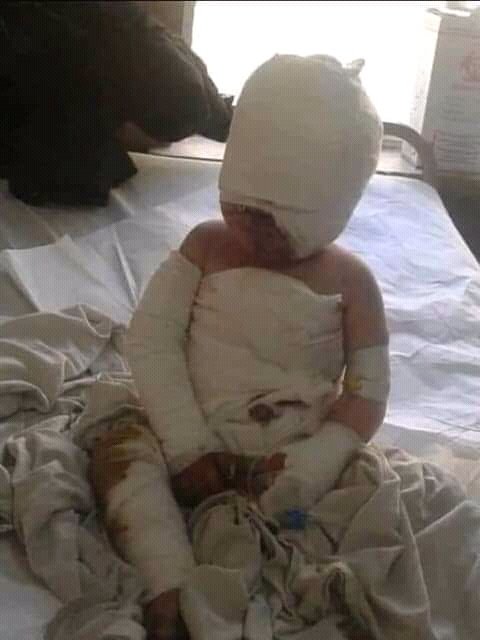 Ahsan35779691's tweet photo. #KilledMothersWithBabies 
#UnitedNations
#UNCIEF
Stopt targeting Hazara people.
They have killed and injured many Hazara pregnent women and newborn babies.
Please help us! https://t.co/IjSZaSV68f