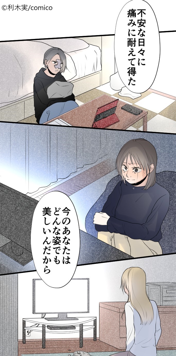 Comico 公式 オリジナル漫画が毎日無料 彼女たちのコンプレックス 更新 レンタル 整形美人編3 T Co Pigvgmdjz0 かつてのマネージャーが訪ねてきて 先読み 整形美人編 完 T Co Rvzspqwq9h 整形 し続けた彼女の物語 完結