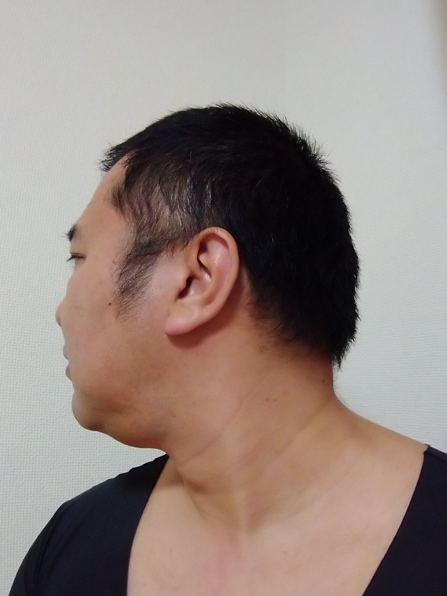 とにかく明るい安村 みんなからしたらそうでもないかもだけど 俺からしたら相当ロン毛