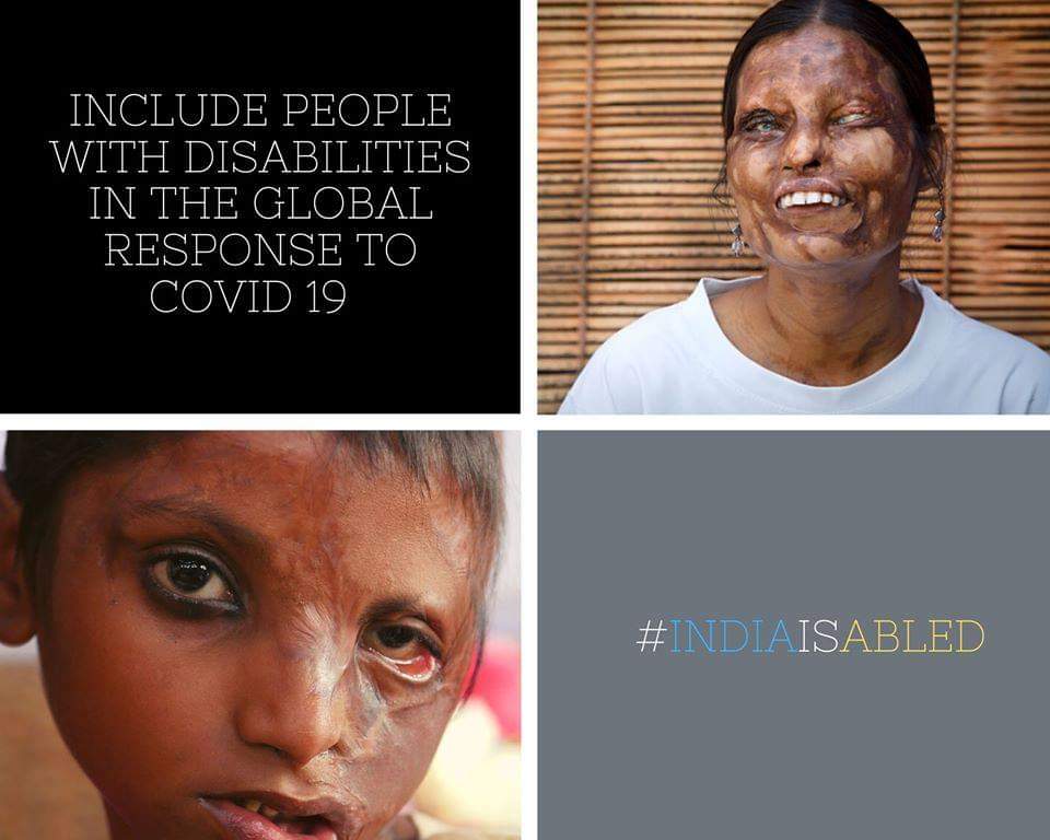 StopAcidAttacks's tweet photo. There are many, who rely on the support provided by their carers are particularly at risk during this difficult period. Be the voice of someone who really need this. 
Sign the petition here; https://t.co/YRCYShFn6a

#Disability #Indiaisabled #makesupportchain #support #eachother https://t.co/FFmWks9qaz