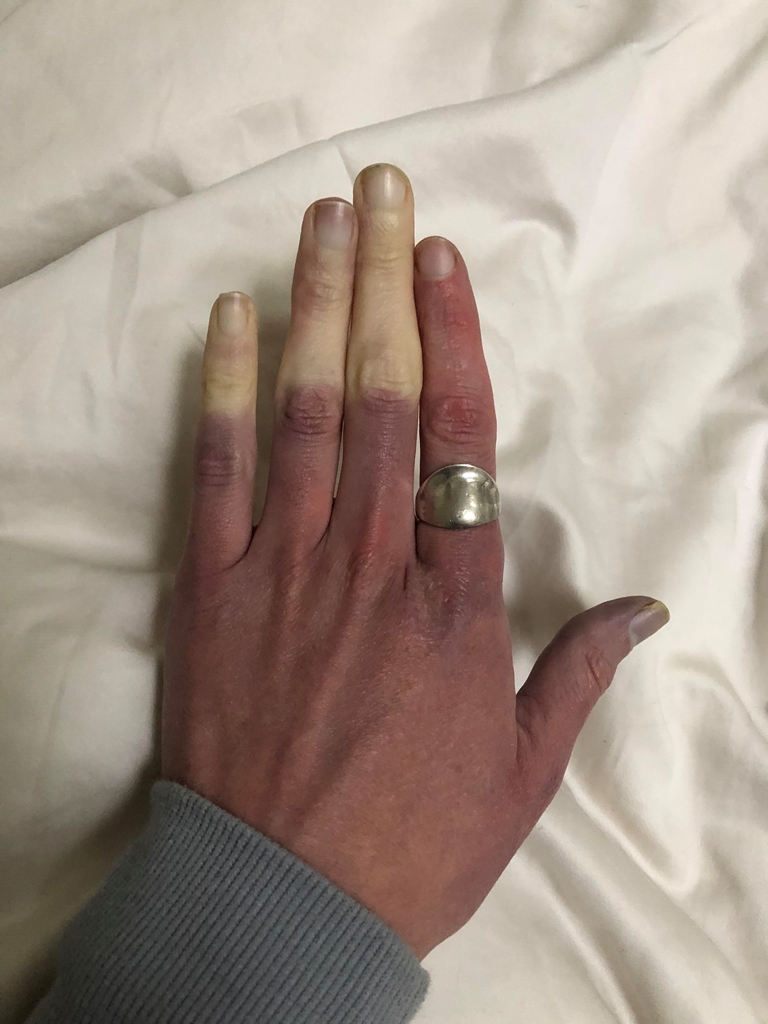 Whoa Interesting (@WhoaInteresting) on Twitter photo 14/05/2020 07:07:03 When it’s marginally chilly, my fingers lose circulation. This time they color blocked When it’s marginally chilly, my fingers lose circulation. This time they color blocked