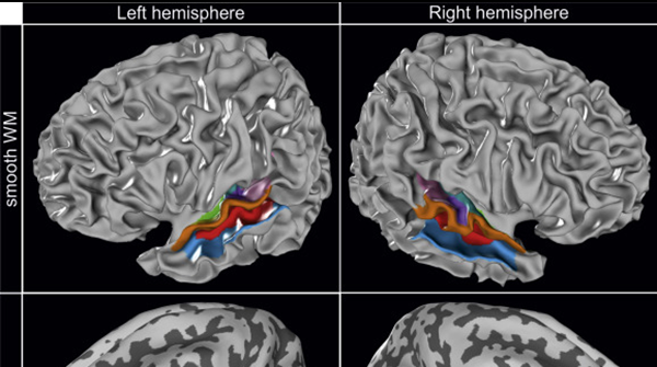 HumanBrainProj's tweet photo. Four new cytoarchitectonic areas surrounding the primary and early auditory cortex in human brains

The new maps are publicly available and provide a basis to explore the structural–functional relationship of the language #network in the temporal #cortex:  https://t.co/fFBxnzzZps https://t.co/dCU81bEtZW