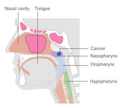 ENTcongress's tweet photo. Researchers applied high-throughput circRNA sequencing to screen the circRNAs with expression variation in nasopharyngeal carcinoma (NPC) patients.

Find more updates at ENT Surgery, visit us at https://t.co/FmGMFv1A2o

#entconference #entupdate #entresearchers #entsurgeon https://t.co/DGPXHQ27ZE