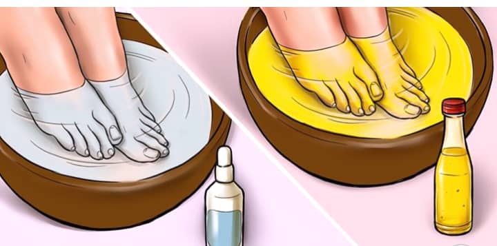 yidiasspa's tweet photo. Yea, dropping tea bags in shoes also works, but this is more of a permanent remedy ( If done consistently). So tag a friend who needs to see this or save and send it to them. Whichever way, just help anyone out that might be experiencing this

#lagoslockdown #yidiasspa #naijaspa https://t.co/FV0YKpRwqv