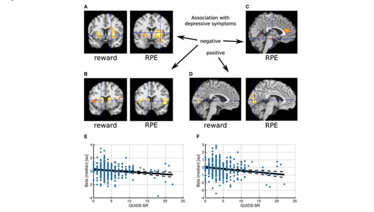 New #imaging findings in depression: Blunted medial prefrontal cortico-limbic reward-related effective connectivity and depression

In the journal Brain:
doi.org/10.1093/brain/…