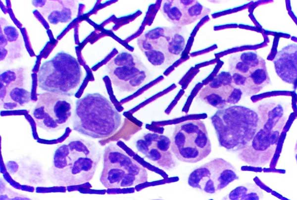 SEMicrobiologia's tweet photo. NOW #EUROmicroMOOC: an open access microbiology course with the collaboration of @FEMSmicro. Every day from Monday to Saturday at 11:00 h (CET) here in Twitter.
TODAY “Microbiological warfare” by
@SoyBiotec start now!
Remember: follow @SEMicrobiologia and #EUROmicroMOOC https://t.co/lW1A6Wcb8m
