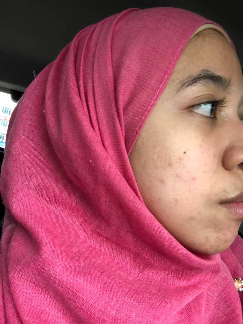 Sheikaempire's tweet photo. MY SKIN JOURNEY 
I’ve tried most local skincare dulu. Tabit*, dm* 360, tat*, and so much more. Flawless mcm telur kulit i okay. Putih tu mmg putih gila! Seronok lah. I realised that if i stop a week, dia naik. Then pkai, flawless balik. Tak ke pelik tu? https://t.co/Pwq1MrqEOj