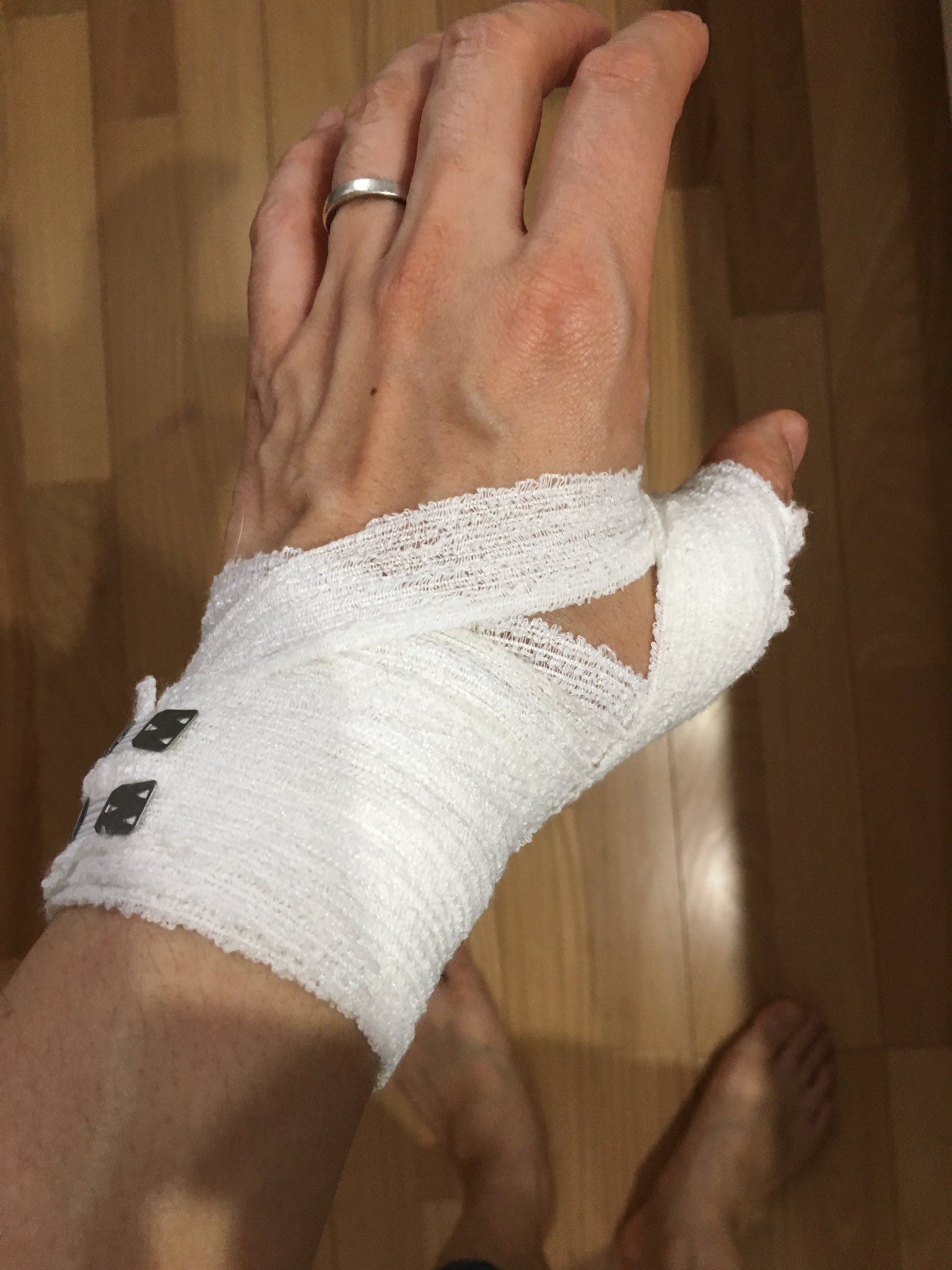 深津健太郎 たろー オドリバラジオ 腱鞘炎になってしもうたが手に巻かれた包帯を見て飛影を思い出す 私の厨二病は終わってない 邪王炎殺黒龍波 巻き方を忘れちまったからな 38歳 一児の父 T Co Cqdi97l9cl Twitter 深津健太郎 たろー オドリバラジオ 腱鞘炎になってしもうたが手に巻かれた包帯を見て飛影を思い出す 私の厨二病は終わってない 邪王炎殺黒龍波 巻き方を忘れちまったからな 38歳 一児の父 T Co Cqdi97l9cl Twitter