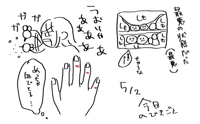 冷凍庫の霜にハサミで挑んだら手をエゲツないほど負傷した(冷たさで痛みに気付かないため) 