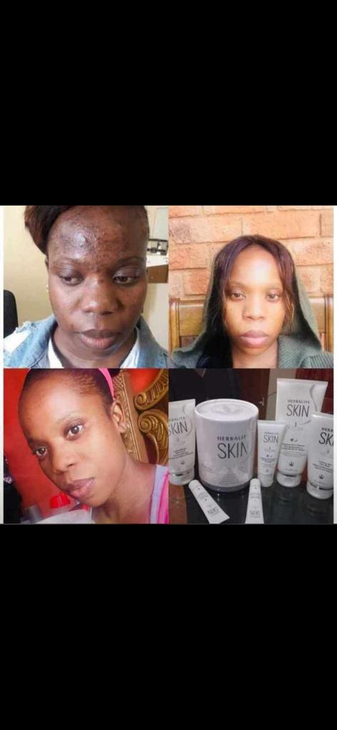 NMzozoyane's tweet photo. I am still taking in new people who want to work on their skin
Kindly text me on 0610889551
#rooiboos #ciara #ntsiki #oats https://t.co/97L2VEKAT1