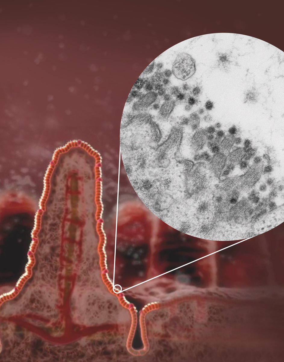 PeterJPeters1's tweet photo. I am very happy to share our team's effort. Research with organoids by the Hubrecht Institute, Erasmus MC and us at Maastricht University shows that the SARS-CoV-2 can also infect the intestines. More details: https://t.co/xNdDP8F0OL 
In the figure many viruses attached to villi https://t.co/Z9F6w9Wpza