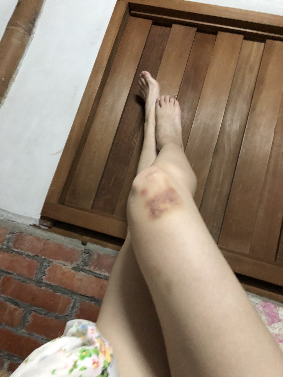 tonicazoo's tweet photo. Get the hurt easily 😅
#영혼의 #수련 https://t.co/YN2MrhO7X7