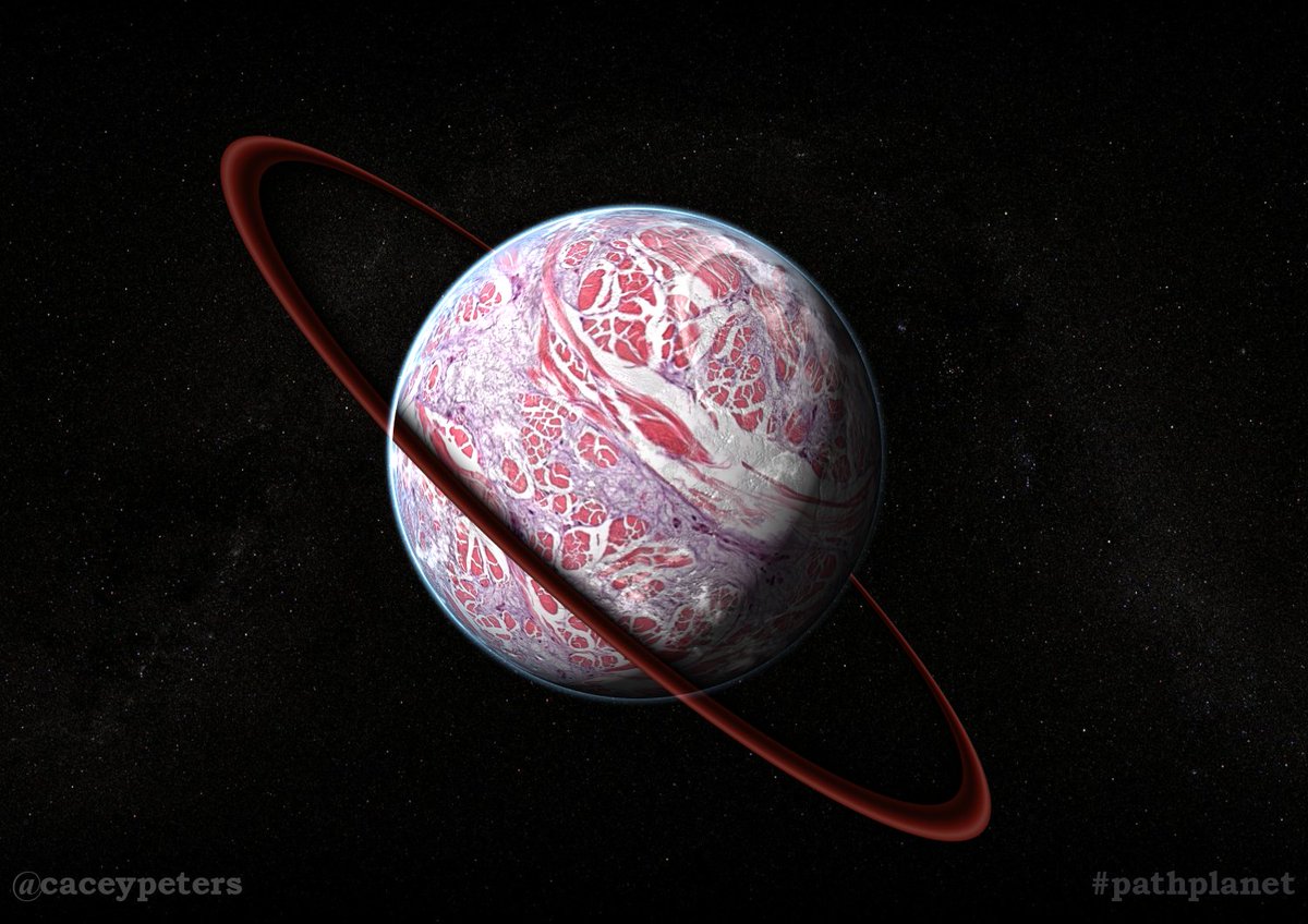 caceypeters's tweet photo. Planet Scleredema
#pathplanet #pathology #pathart #dermpath #dermatology #astronomy #histology https://t.co/SMOvetWop5