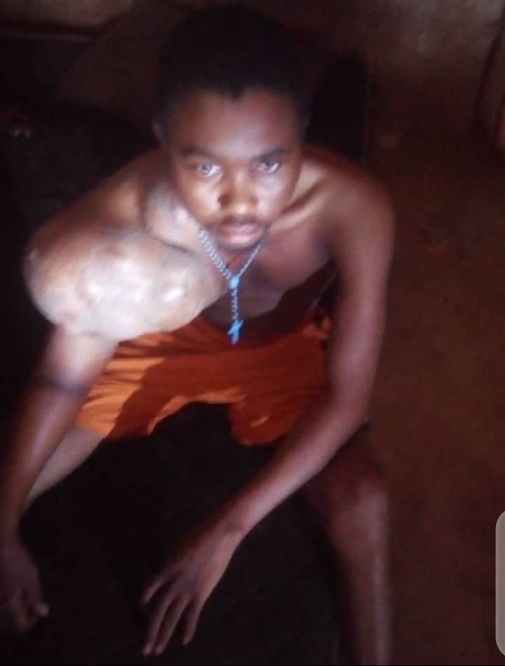 kizitopng's tweet photo. Many of you would probably ignore, but please I need your help In saving my friends life. Any amount of money would go a long way. I pray God Almighty blesses you as you do so. Amen https://t.co/Rwvpl9Z6Xt