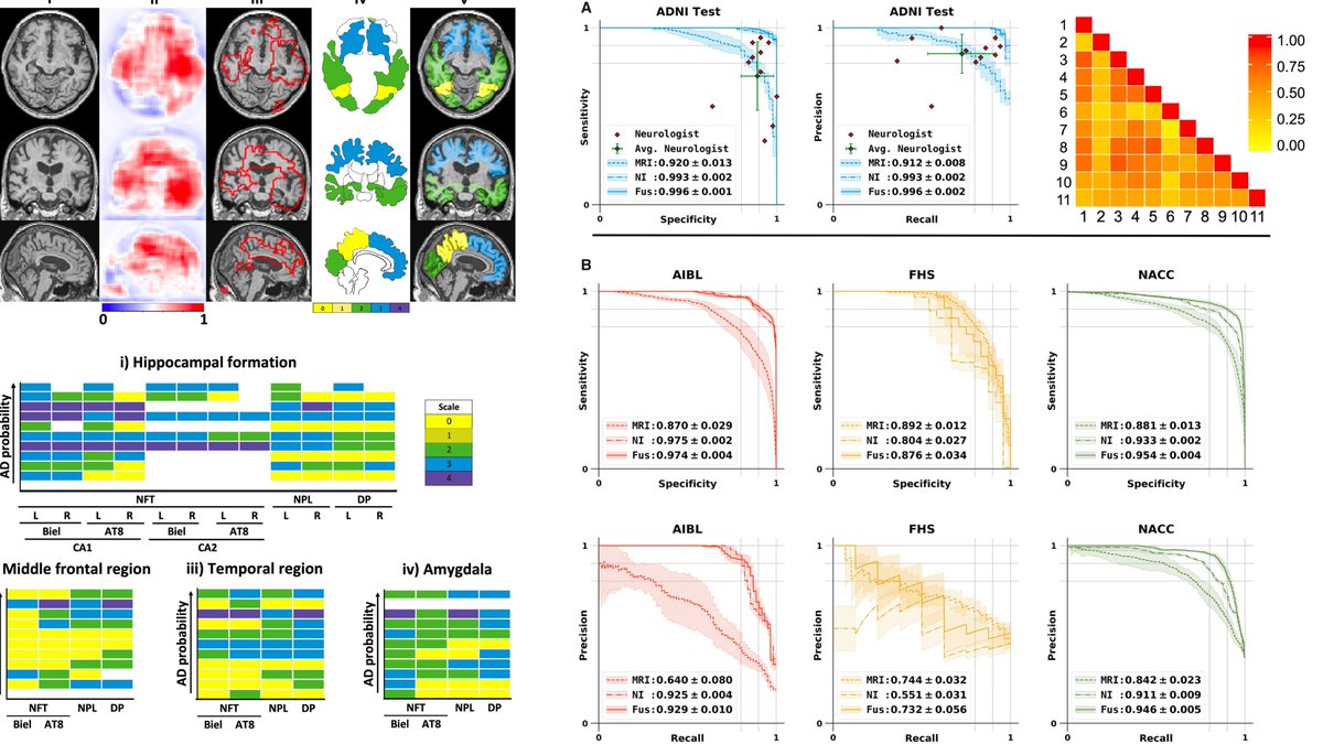 gp_pulipaka's tweet image. Development of #MachineLearning Framework for #Alzheimer’s Classification. #BigData #Analytics #DataScience #AI  #IoT #IIoT #PyTorch #Python #RStats #JavaScript #ReactJS #CloudComputing #Serverless #Linux #Programming #Coding #100DaysofCode #HealthTech
academic.oup.com/brain/advance-…
