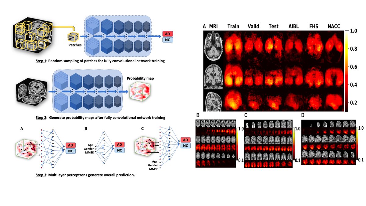 gp_pulipaka's tweet image. Development of #MachineLearning Framework for #Alzheimer’s Classification. #BigData #Analytics #DataScience #AI  #IoT #IIoT #PyTorch #Python #RStats #JavaScript #ReactJS #CloudComputing #Serverless #Linux #Programming #Coding #100DaysofCode #HealthTech
academic.oup.com/brain/advance-…