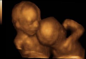 ArianeBlackRP's tweet photo. Mauvaise nouvelle pour un des faux jumeaux, le garçon va se faire opérer à sa naissance même si j'ai envie de pleurer je tiens le choc

@JessThiveninRpg @JujuTantirp https://t.co/k2DJSMBbKb