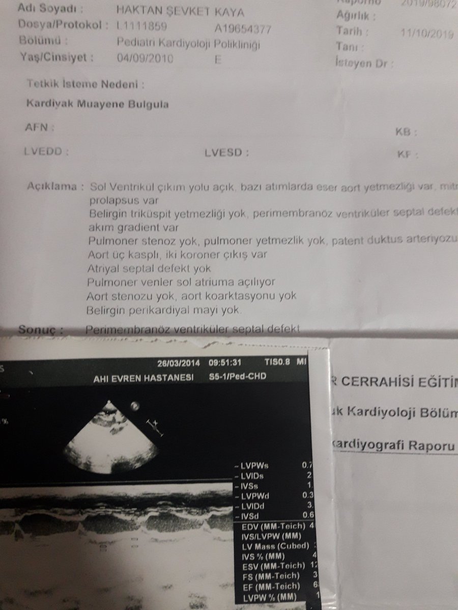 Kredimiz 32 gündür degerlendirilmede eşim işsiz kiralar birikti faturalar birikti ev sahibi çık diyor iki hasta çocugum var oglum kalp hastasi üzülünce bayiliyor aç kalinca bayiliyor çaresizim destek kredisi ihtiyaci olana verilecekti #bakanalbayraksözünütut #BuYoldanDönmeyeceğiz