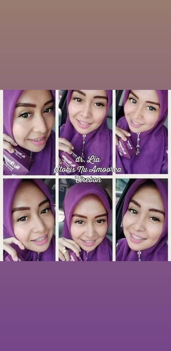 ani_rizqi's tweet photo. https://t.co/oYvmzjLyRX