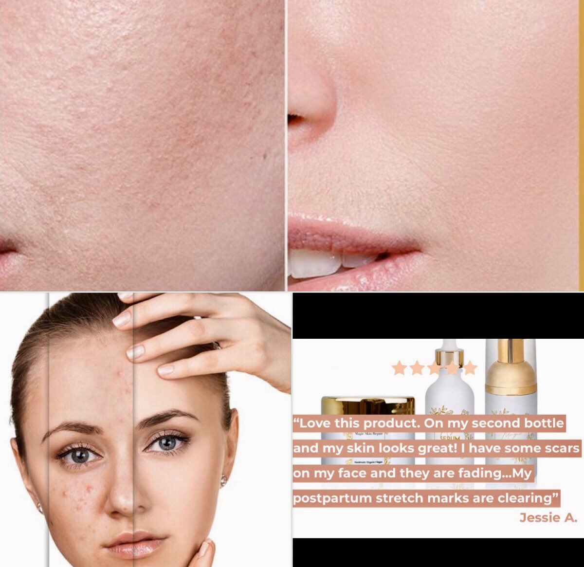 MagicSkinRepai2's tweet photo. Take 10% off your order now code: FIRST https://t.co/mo4NEypQQZ #magicskinrepair #naturalskincare #skincare #organicskincare #skincareroutine #beauty #natural #naturalbeauty #healthyskin #organic #glowingskin #antiaging  #scars #selfcare #cleanbeauty #skincareproducts #blackskin https://t.co/uxpfca4cJP
