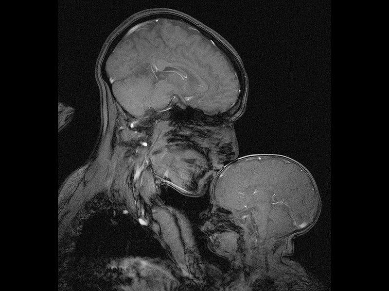 MineEYMind's tweet photo. Not new but still captivating. MRI scan of (neuroscientist) mum caressing &amp; kissing her baby inside the tube of a scanner (WOW). Look at the brains. What do you notice? 
I find this image deeply moving, mesmerising. 
We are fragile, built in love. What words come to mind for you? https://t.co/IKq530Q1tO