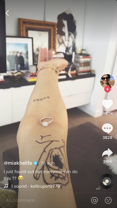 @miakhalifa you might have L&eacute;ri-Weill dyschondrosteosis, id comment on the video but I doubt you&rsquo;d see<a class="tags" href="/tag/miakhalifa">@miakhalifa</a><a href="/tag/petty"class="tags"><span>#petty</span></a>