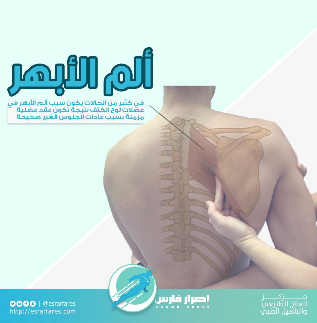 أسرع علاج الم الابهر في الظهر