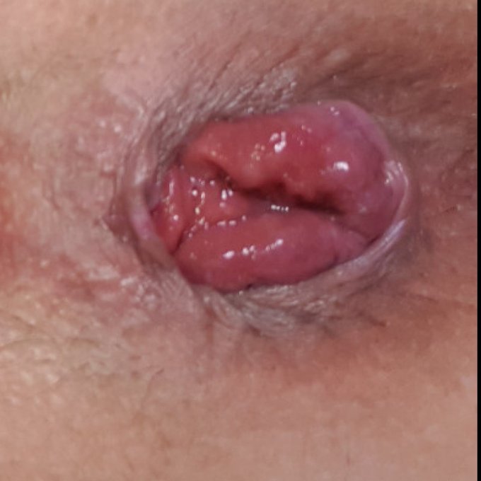 P r o l a p s and pussy open by @onlyjulia3 https://t.co/cXOA7t0ce9 Find it on #ManyVids! https://t.<a class="tags" href="/tag/onlyjulia3">@onlyjulia3</a><a href="/tag/manyvids"class="tags"><span>#manyvids</span></a>